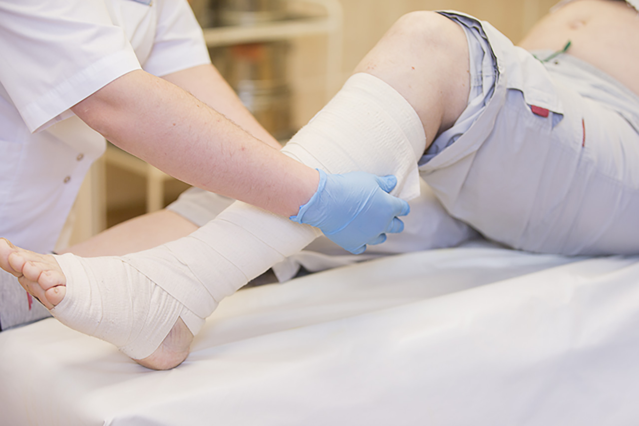 nurse bandages leg fracture from slip and fall accident