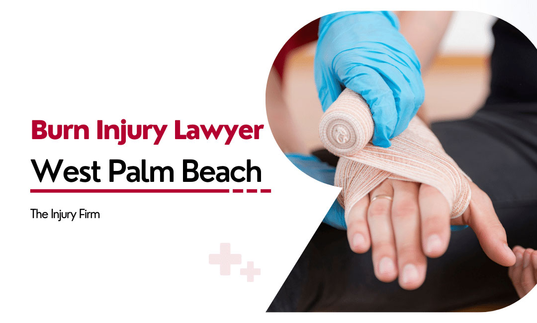 burn injury lawyer west palm beach