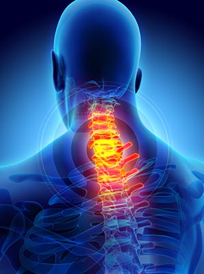 Spinal cord image graphic showing painful neck area.