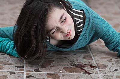 young girl slip fall accident on floor with bleeding nose 